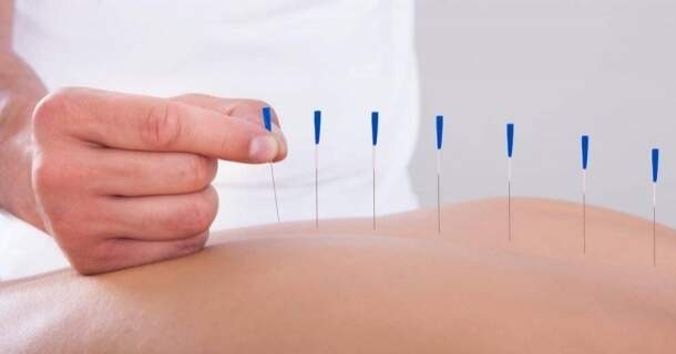 Noções Básicas da Acupuntura Chinesa 