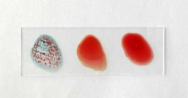 Noções Básicas em Auxiliar de Imunohematologia 