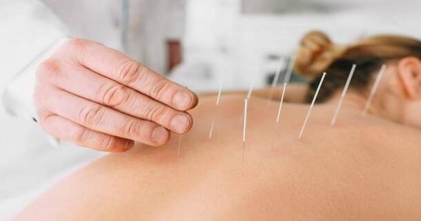 noções de acupuntura 